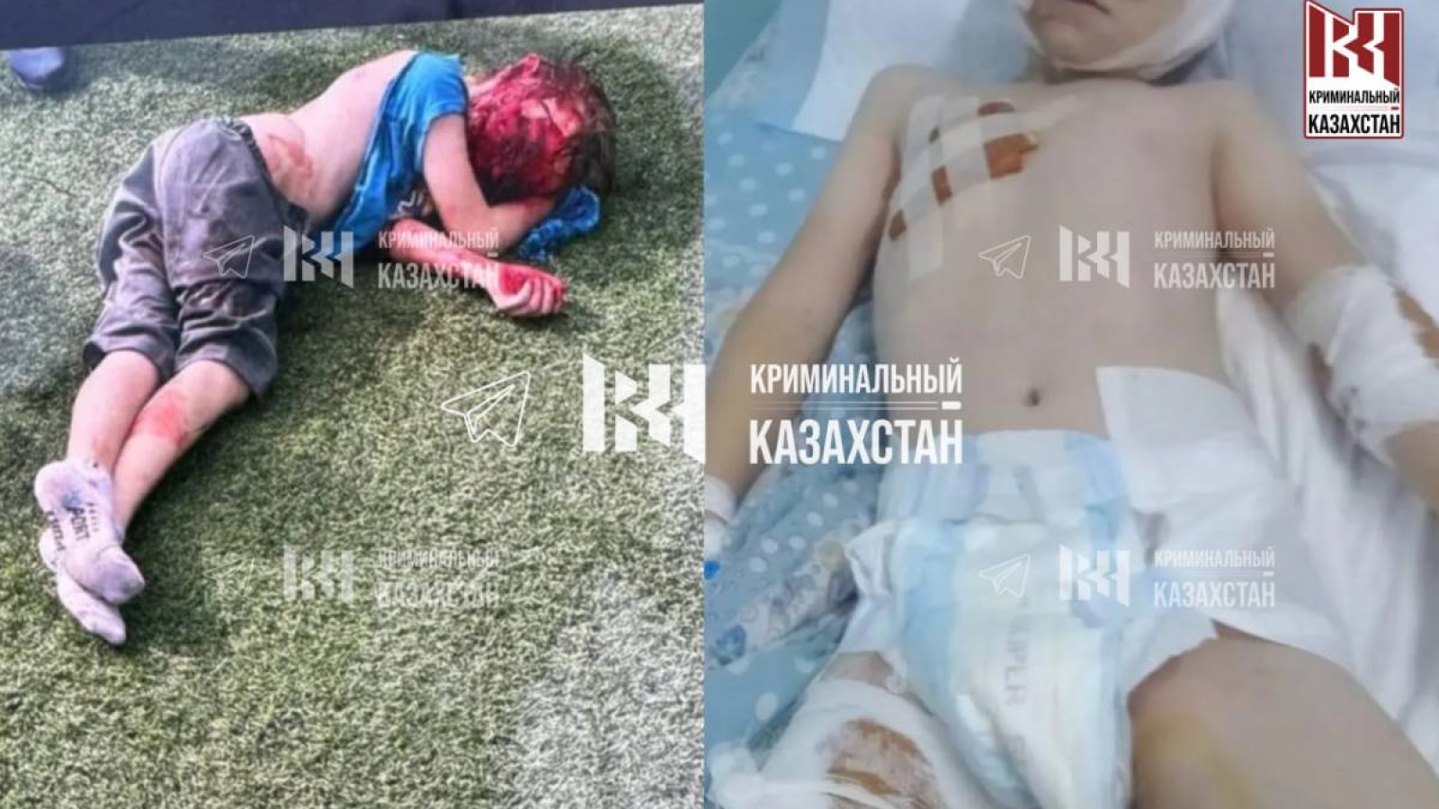 Алматы облысында төбелескіш иттер 10 жастағы баланы талап тастады.