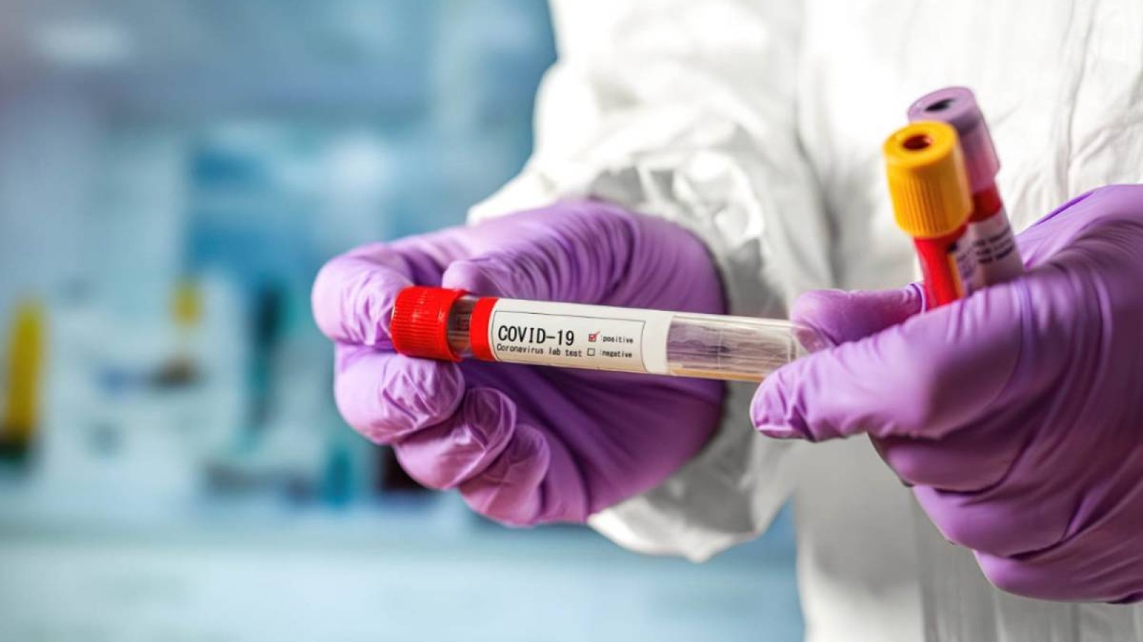 Елімізде коронавирус жұқтырғандардың рекордты саны тіркелді.