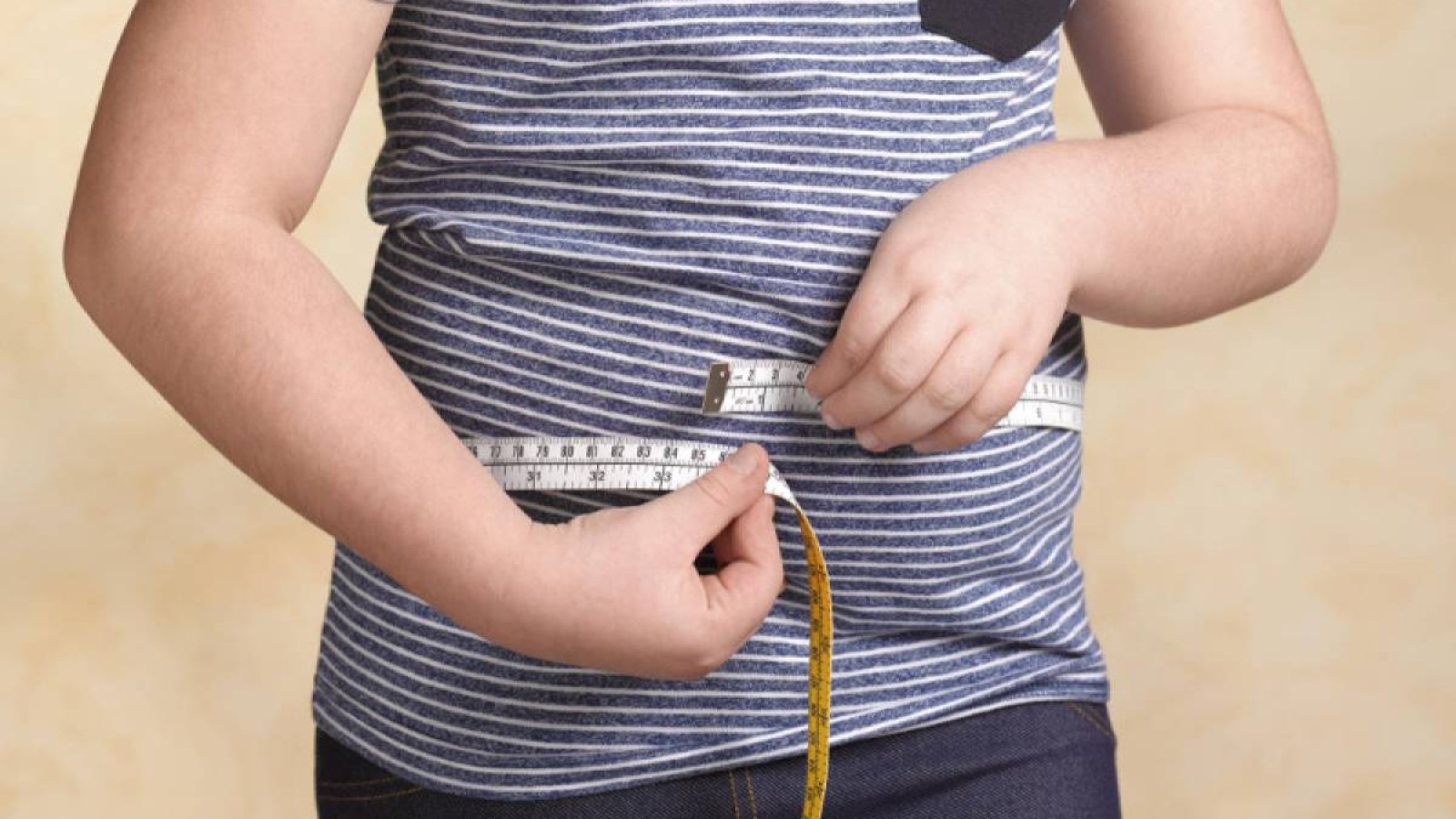 Елде «семіздік» дертіне шалдыққан балалар саны көбейіп келеді.