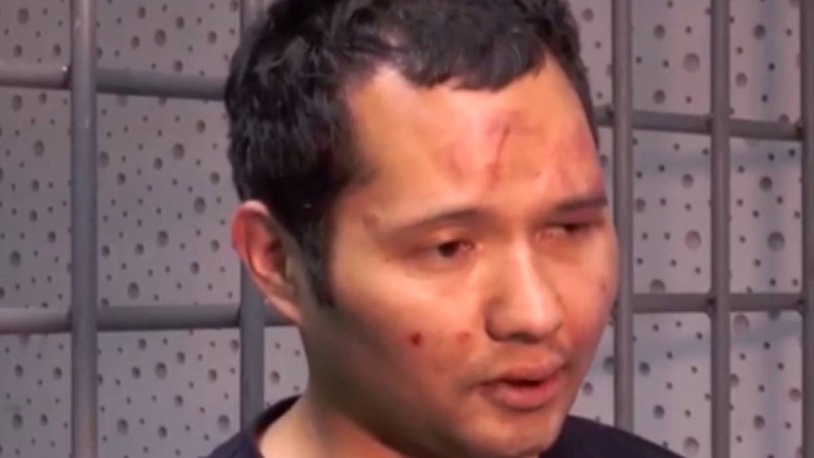 «Қаңтар» оқиғасы кезінде азапталған қырғыз әншісіне ауыр зиян келгені дәлелденді.