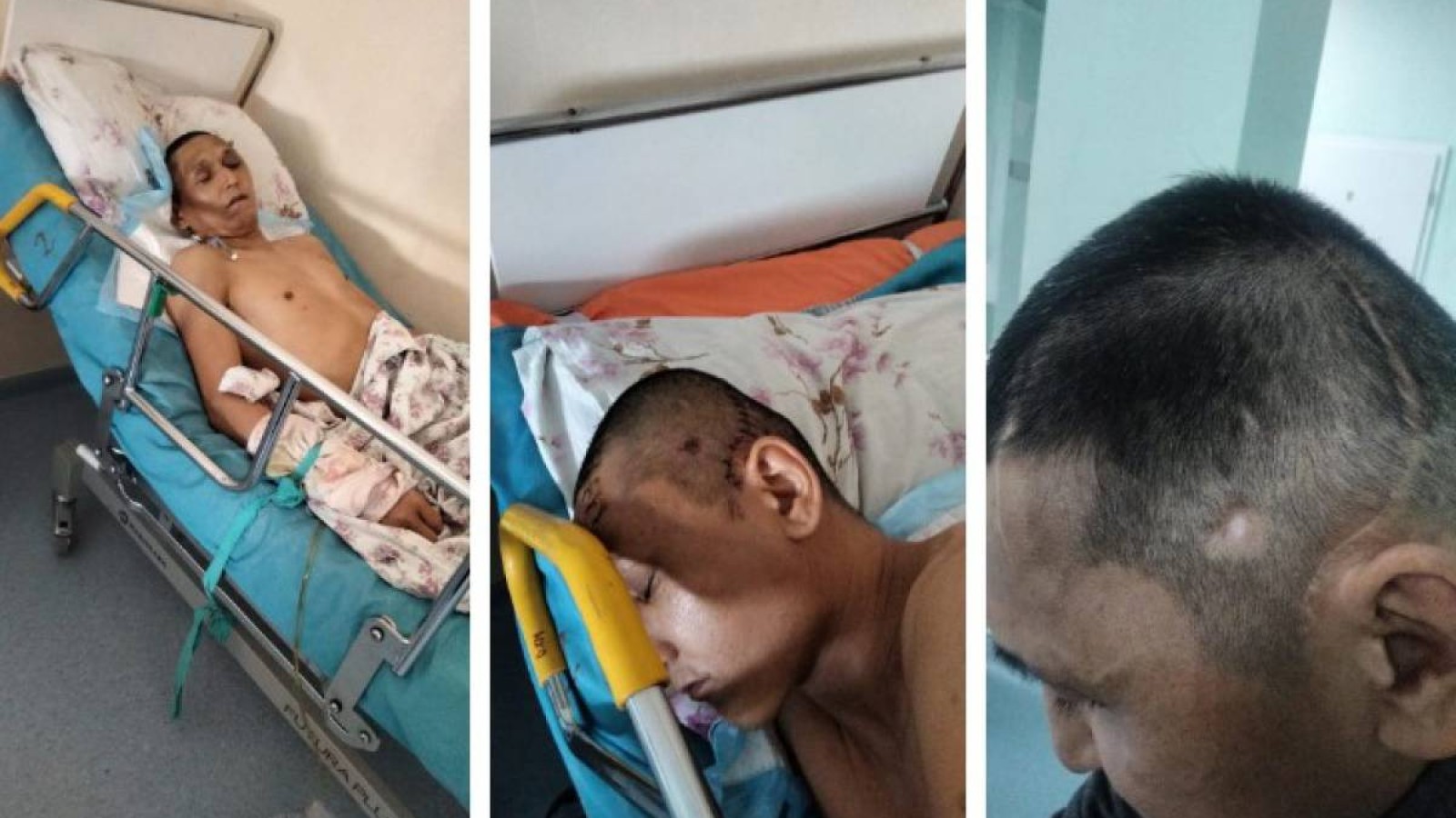 Астанадағы зауыттардың бірінде мүгедек болып қалған ер адамға өтемақы төленбеген.