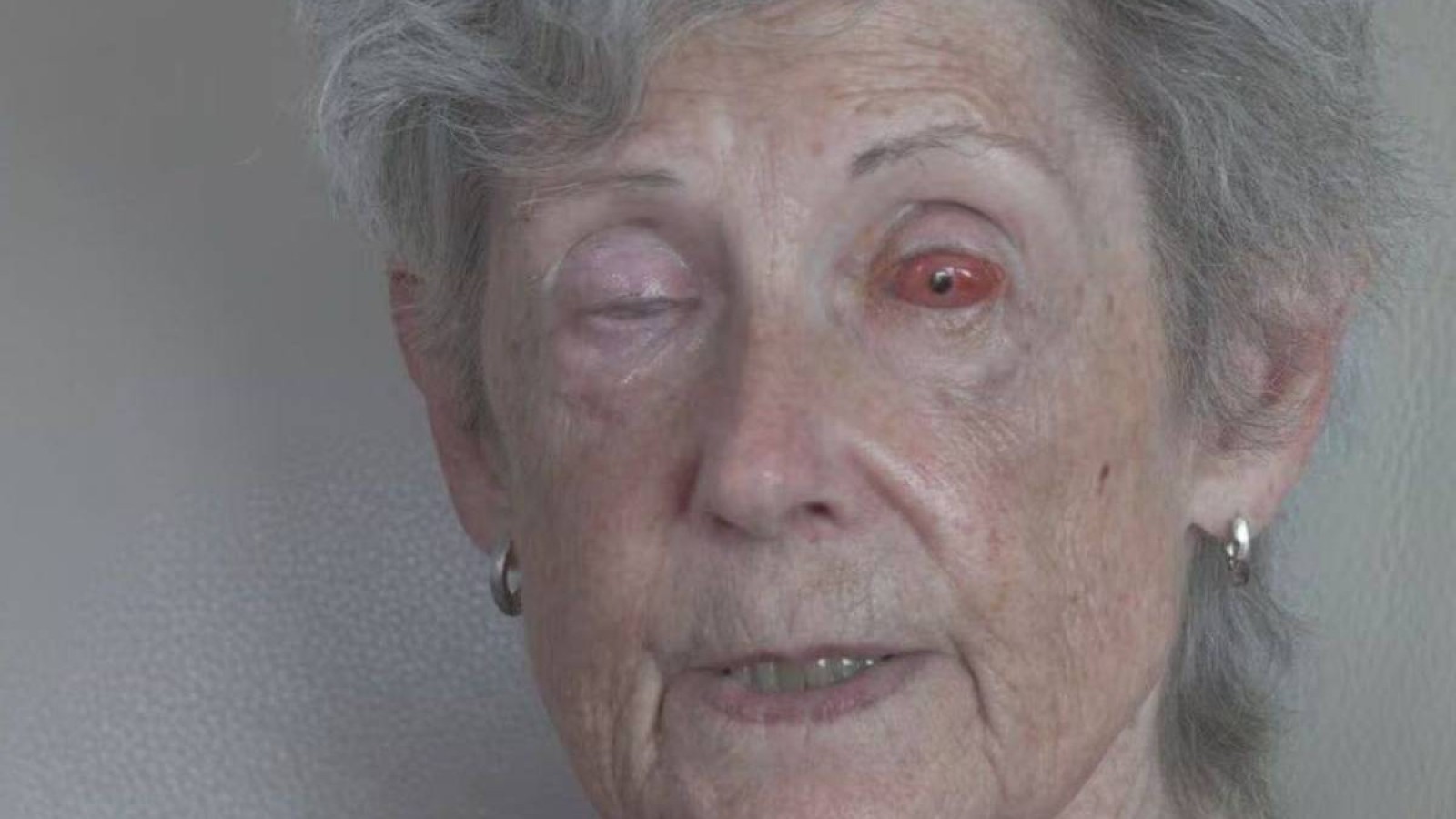 Тісін көзіне салған: 75 жастағы әйелдің көзі қайта көріп, сұмдық жаңалықтың бетін ашты