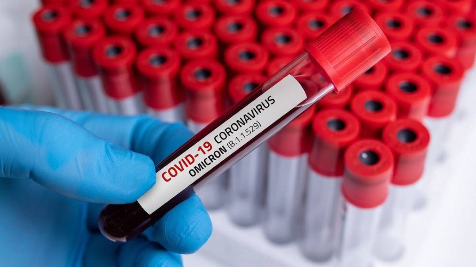 Әзербайжанда COVID-19-ға байланысты карантин режимі 2027 жылға дейін ұзартылды