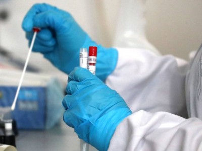 Елімізде індеттің күндік көрсеткіші маусыммен салыстырғанда 5,2 есеге өсті.