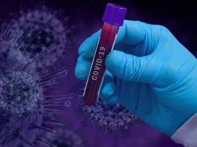 Өткен тәулікте коронавирус жұқтырғандардың саны 1526 адамды құрады.