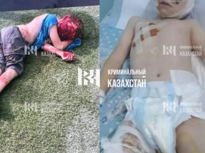 Алматы облысында төбелескіш иттер 10 жастағы баланы талап тастады.