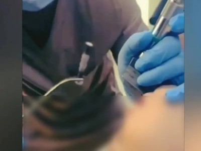 Шымкентте 1 жасар бала 4 сантиметрлік шеге жұтып қойған
