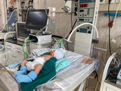 Алматыда салмағы 700 грамм болған нәресте аман қалды