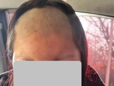 Кәмелетке толмаған қызды ұрып-соғып, шашын қырып тастаған (ФОТО)