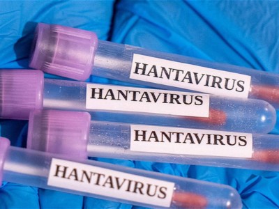 Францияда хантавирустың алғашқы жағдайы тіркелді