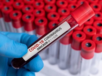 Әзербайжанда COVID-19-ға байланысты карантин режимі 2027 жылға дейін ұзартылды
