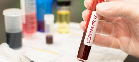 Алматыда 12 дәрігер коронавирус жұқтырған.