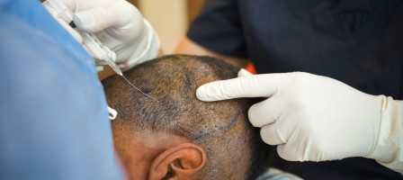 38 жастағы азамат шаш өсіремін деп қайтыс болды