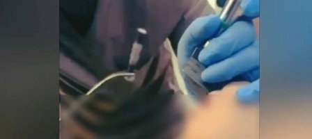 Шымкентте 1 жасар бала 4 сантиметрлік шеге жұтып қойған
