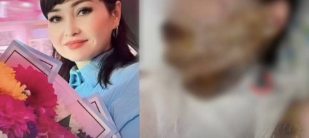 «Мен сені адам танымастай қылып тастаймын»: Шымкентте ер адам әйеліне қышқыл төкті