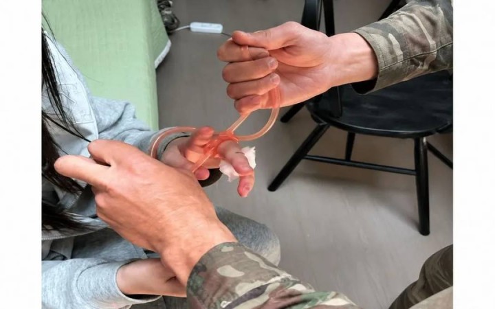 Көлсай көлдерінде 16 жастағы қызды жылан шағып алды