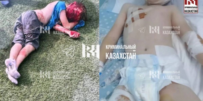 Алматы облысында төбелескіш иттер 10 жастағы баланы талап тастады.