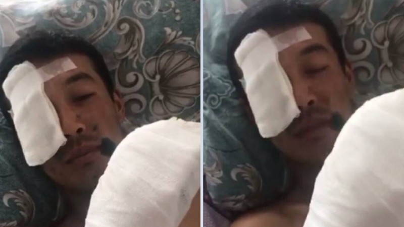 Әскерилер қашып кеткен жерге өрт сөндірушілер жіберілген.