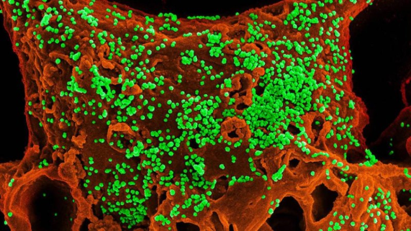 Коронавирустан 213 адам қайтыс болып, 10 мыңға жуық адам вирус жұқтырған.