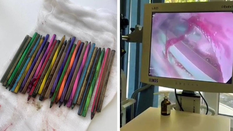 Шымкентте ер адам бәстесіп, 26 қаламды жұтып қойған