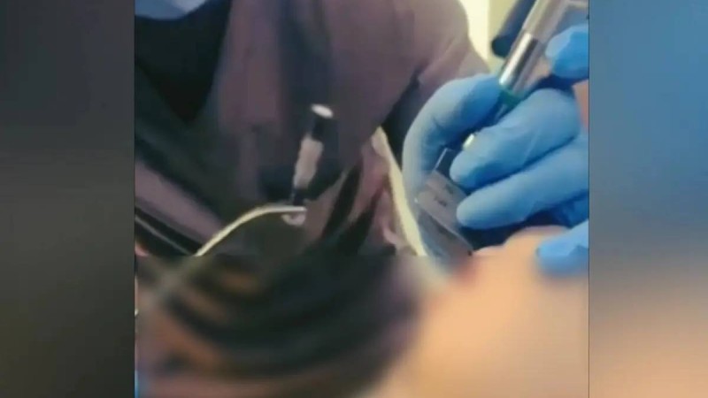 Шымкентте 1 жасар бала 4 сантиметрлік шеге жұтып қойған