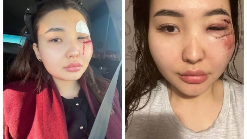 «Зиратқа апарып, ұрып-соққан»: Атырауда блогер ісі бойынша сот басталды