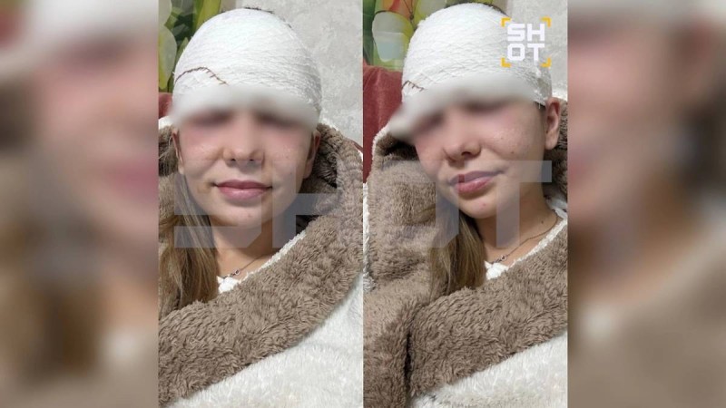 28 жастағы келіншек маңдайындағы безеуін сығамын деп өмірінен айрылып қала жаздады (ФОТО)