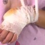 Ақтөбеде аттракционға мінген 5 жасар қыздың саусағы жұлынып кетті