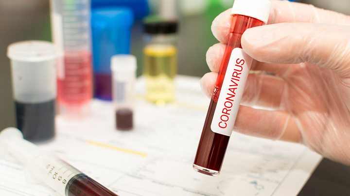 Ресей Қазақстанға коронавирусты анықтайтын тест-жүйесін жіберді