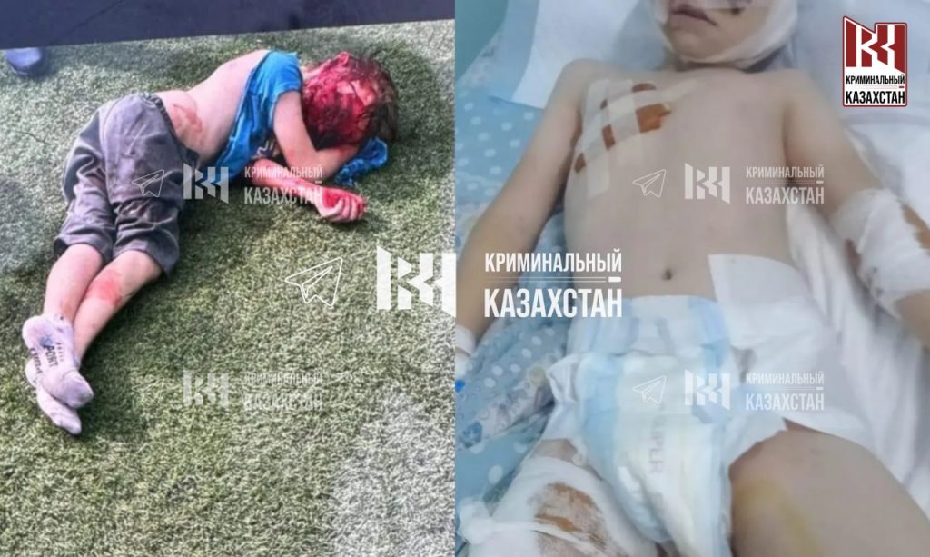 Алматы облысында төбелескіш иттер 10 жастағы баланы талап тастады