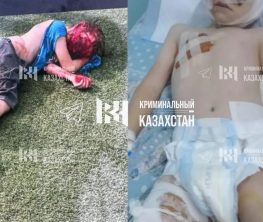 Алматы облысында төбелескіш иттер 10 жастағы баланы талап тастады